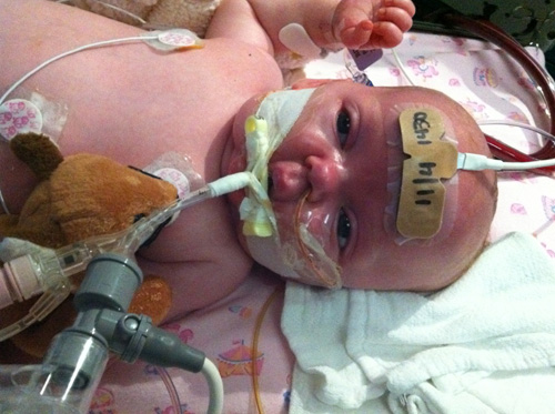 pertussis-baby-three-lg